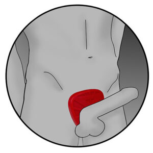 Electrastim-Silicone Fusion Viper Scut Penian 19 Electrastim-Silicone Fusion Viper Scut Penian - imagine 9